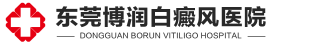 东莞白癜风医院